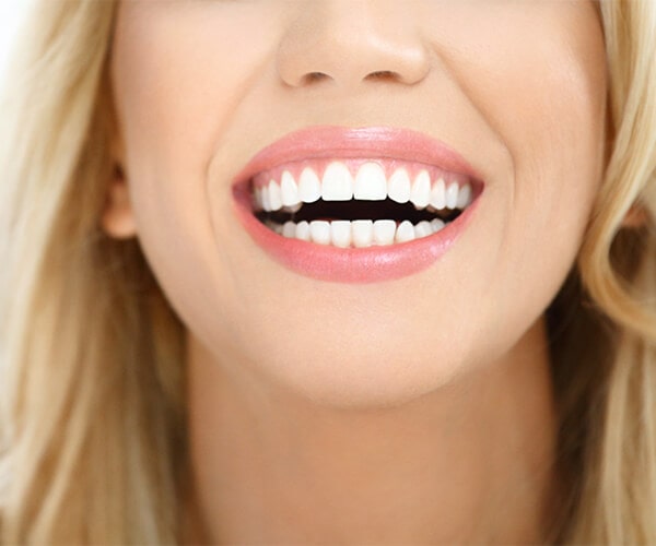 Hygiene - White teeth with Vashon dentist