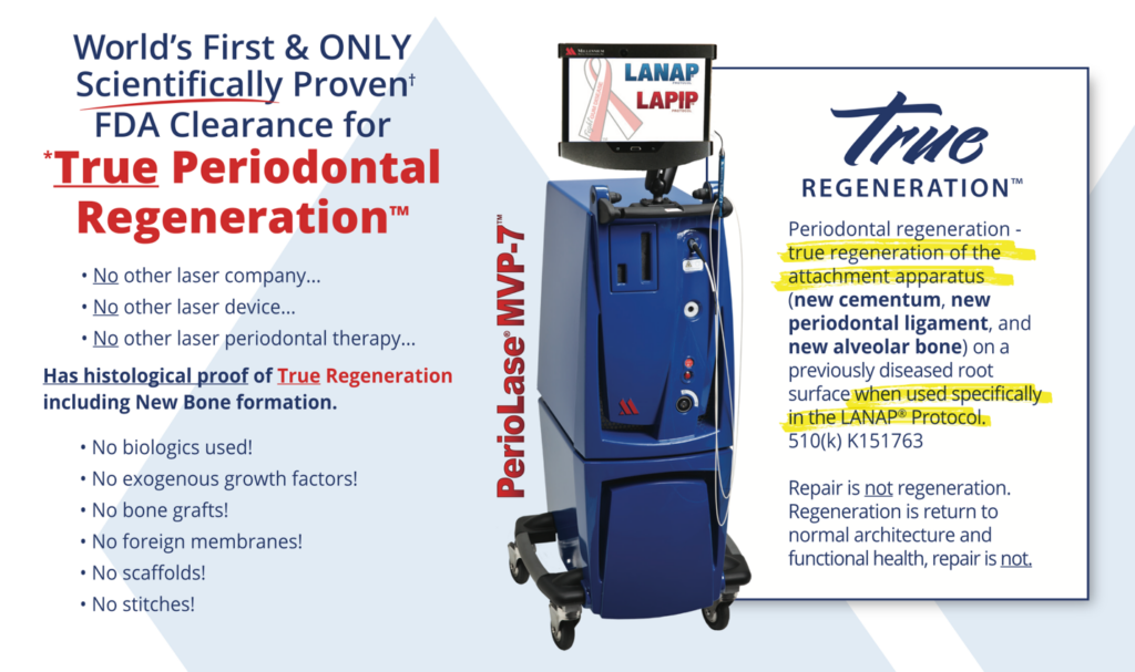 Laser Assisted Periodontal Therapy - LANAP® Protocol - LANAP Dentistry - Laser Machine